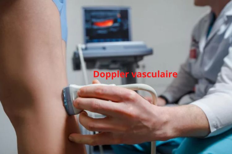 echo-doppler-vasculaire-veineux-et-arteriel