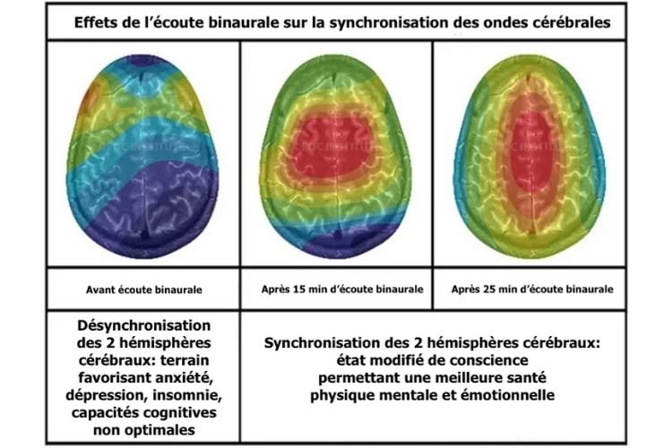 les-sons-binauraux-entrainent-une-synchronsation-des deux-hemispheres-cerebraux