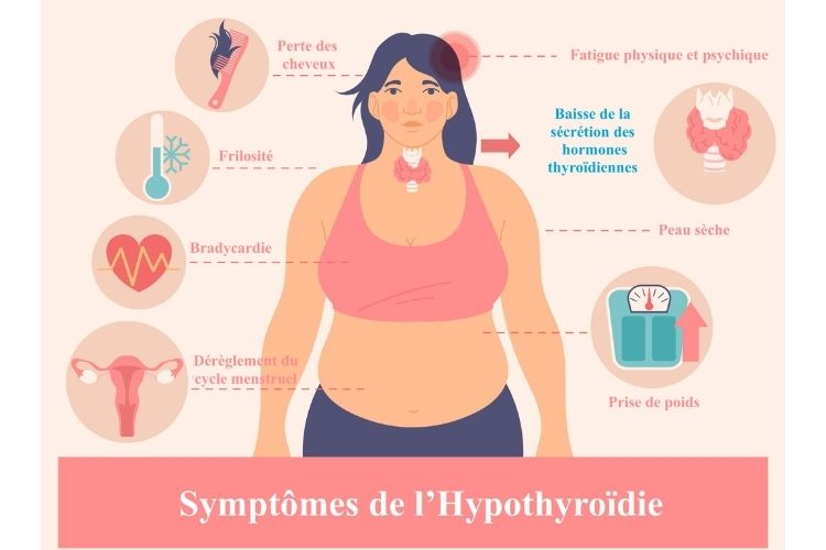 quels-sont-les-symptomes-de-l-hypothyroidie